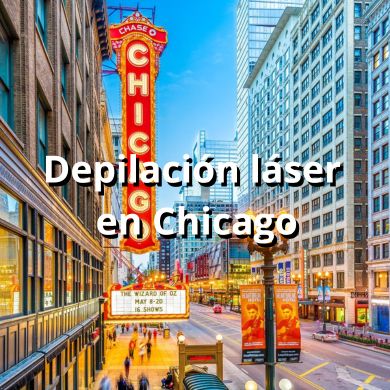 Depilacion laser en Chicago