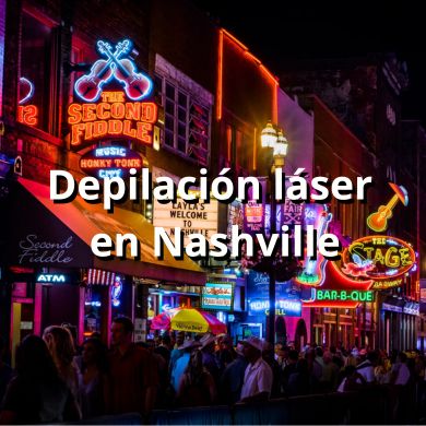 Depilacion laser en Nashville